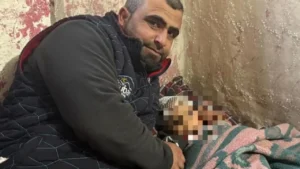 Kayseri’de Köpek Saldırısı Mağduru Minik A.D., 34 Gün Sonra Evine Döndü: Baba Adalet İstiyor