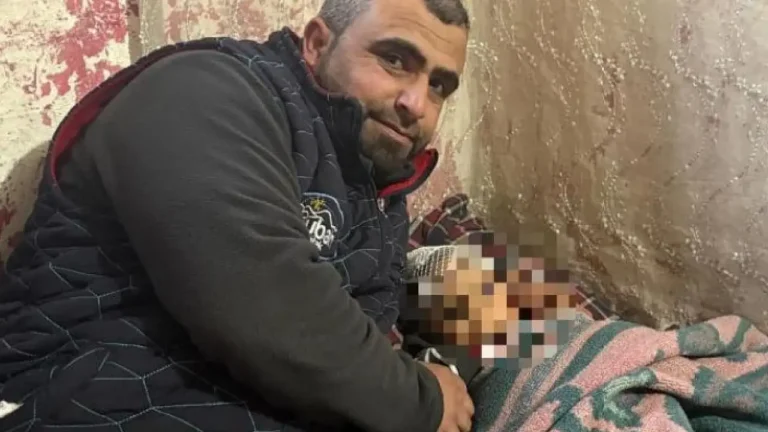 Kayseri’de Köpek Saldırısı Mağduru Minik A.D., 34 Gün Sonra Evine Döndü: Baba Adalet İstiyor