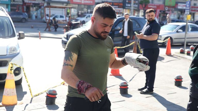 Kayseri’de Kurban Bayramı’nın İlk Gününde Acemi Kasaplar Hastanelik Oldu