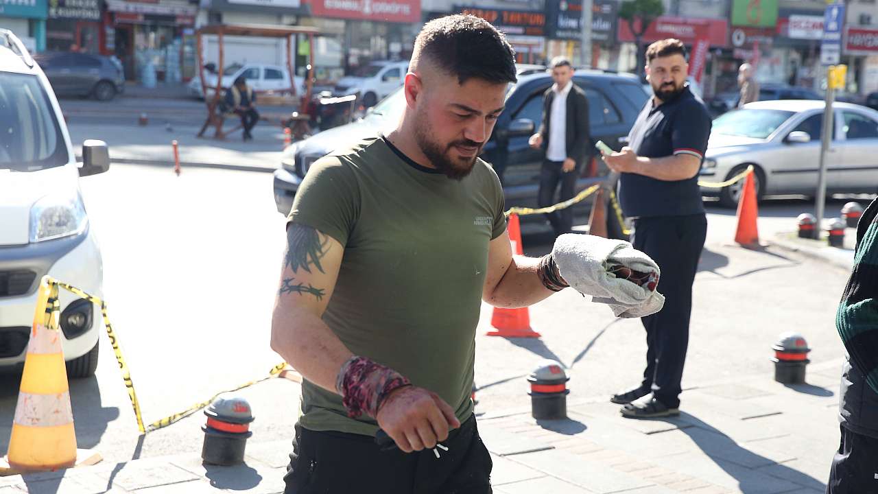 Kayseri'de Kurban Bayramı'nın İlk Gününde Acemi Kasaplar Hastanelik Oldu